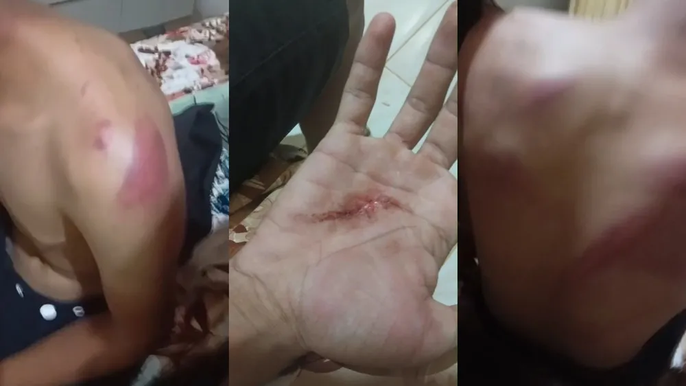 Família denuncia que policiais torturaram jovem com faca, marteladas e saco na cabeça no Ceará