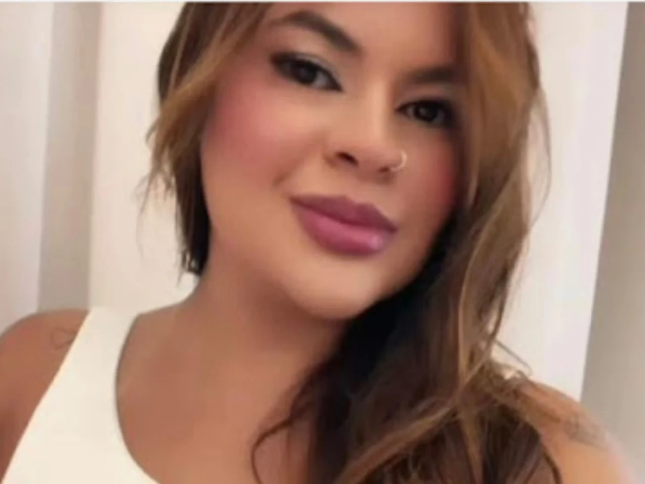 Jovem mutilada com foice por ex-namorado no interior do Ceará tem mãos reimplantadas